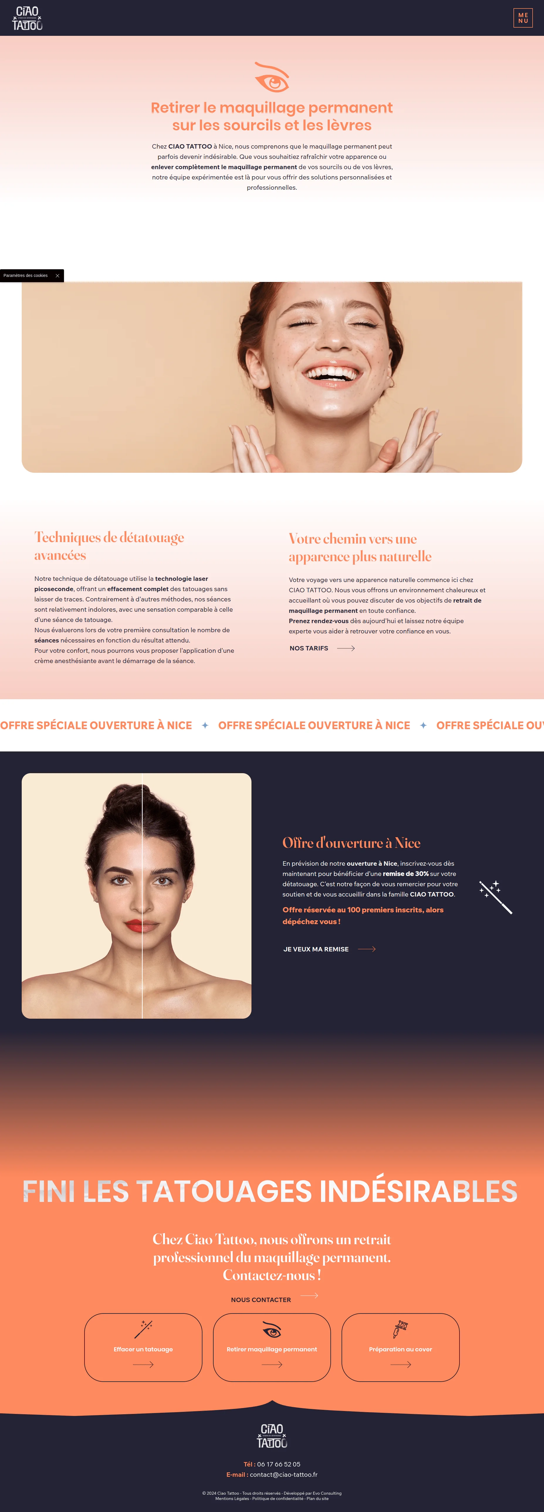 screencapture-ciao-tattoo-fr-retirer-un-tatouage-2025-06-02-11_49_34-min